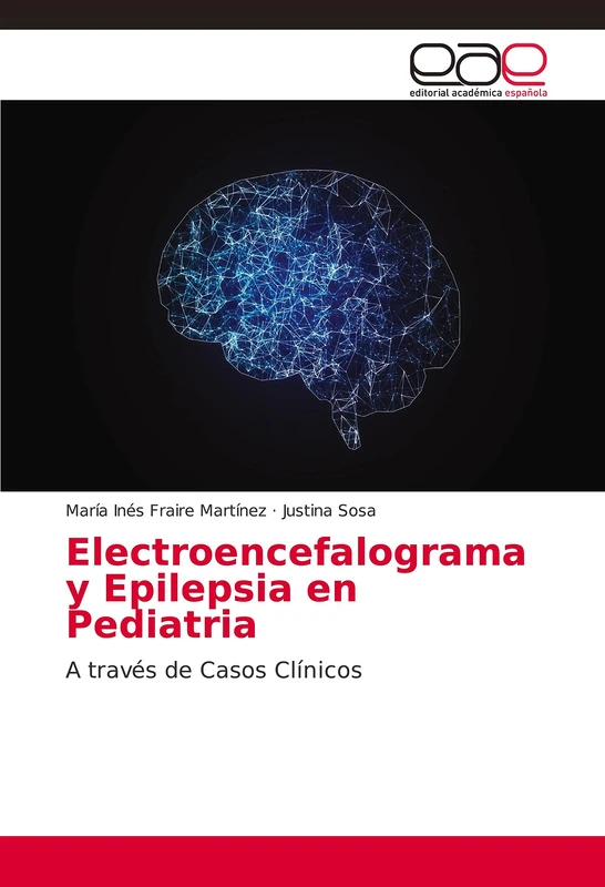 Electroencefalograma y Epilepsia en Pediatria: A través de Casos Clínicos