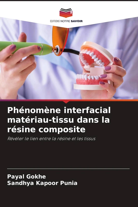 Phénomène interfacial matériau-tissu dans la résine composite: Révéler le lien entre la résine et les tissus - Image 1