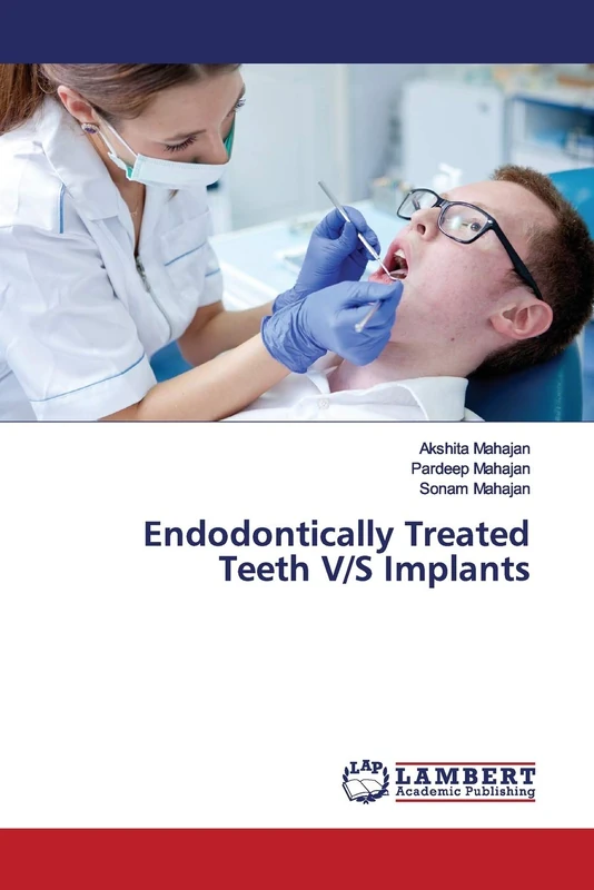 Endodontically Treated Teeth V/S Implants - Image 1