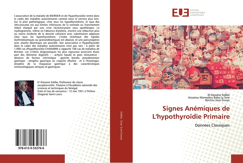 Signes Anémiques de L'hypothyroïdie Primaire: Données Classiques