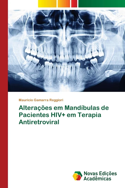 Alterações em Mandíbulas de Pacientes HIV+ em Terapia Antiretroviral - Image 1