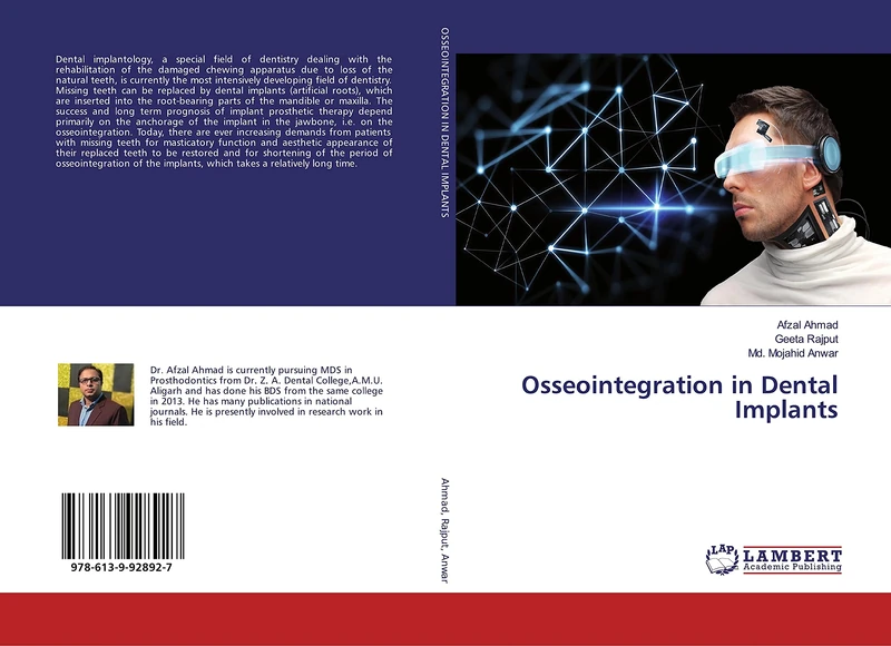 Osseointegration in Dental Implants