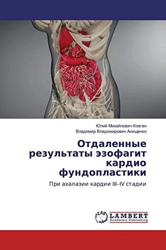 Отдаленные результаты эзофагит кардио фундопластики: При ахалазии кардии III–IV стадии - Image 1