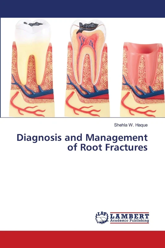 Diagnosis and Management of Root Fractures - Image 1