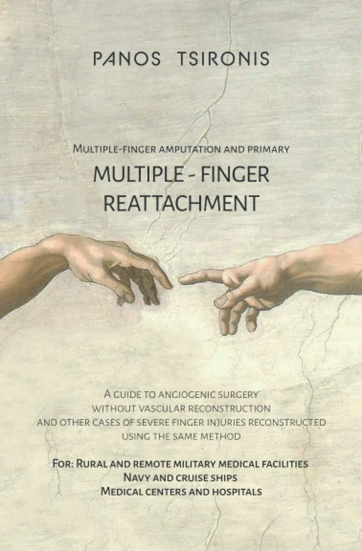 Multiple-finger amputation and primary multiple-finger reattachment: A guide to angiogenic surgery without vascular reconstruction and other cases of ... injuries reconstructed using the same method - Image 1