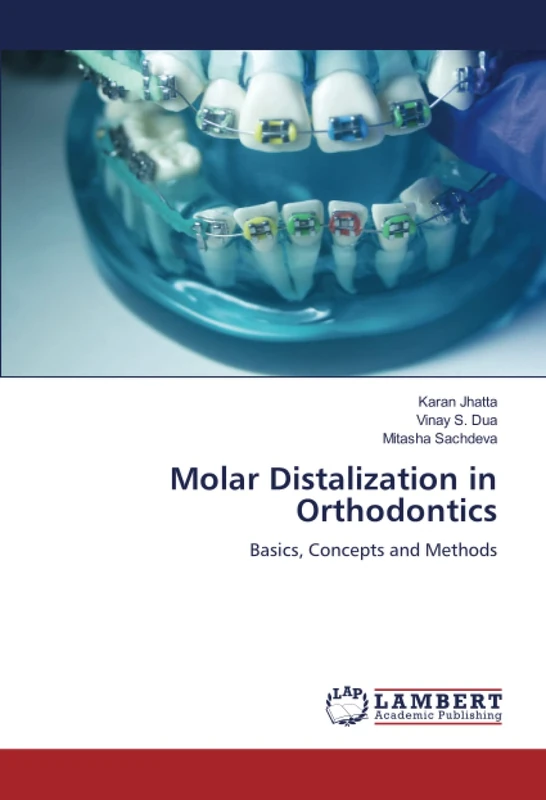 Molar Distalization in Orthodontics: Basics, Concepts and Methods