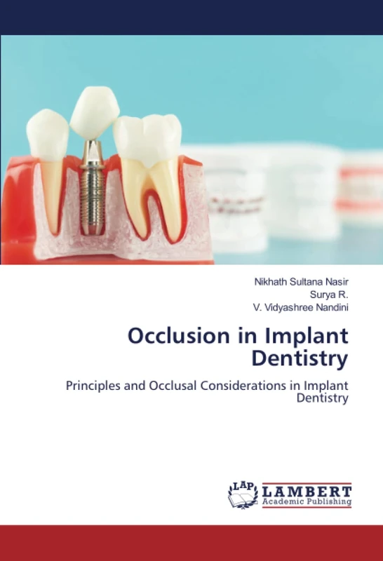 Occlusion in Implant Dentistry: Principles and Occlusal Considerations in Implant Dentistry