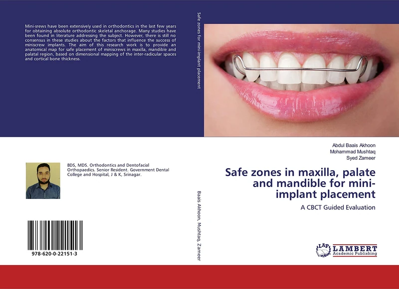 Safe zones in maxilla, palate and mandible for mini-implant placement: A CBCT Guided Evaluation