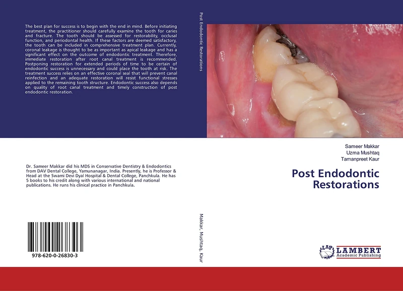 Post Endodontic Restorations