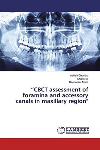 “CBCT assessment of foramina and accessory canals in maxillary region"