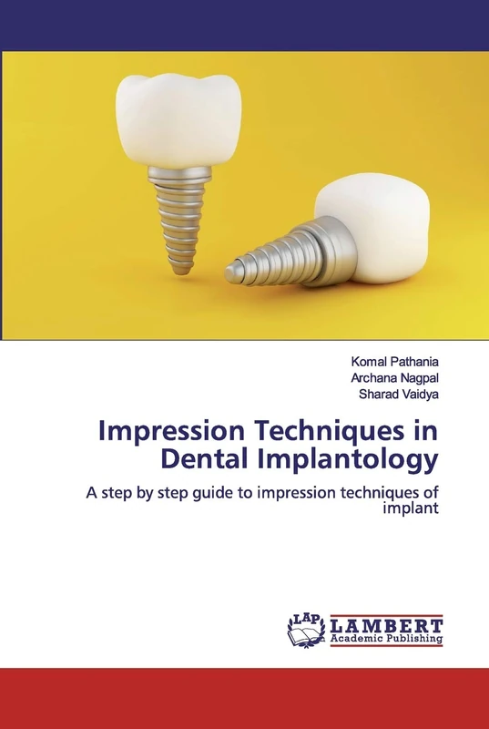 Impression Techniques in Dental Implantology: A step by step guide to impression techniques of implant