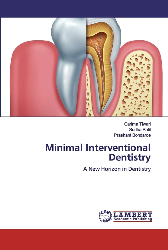 Minimal Interventional Dentistry: A New Horizon in Dentistry