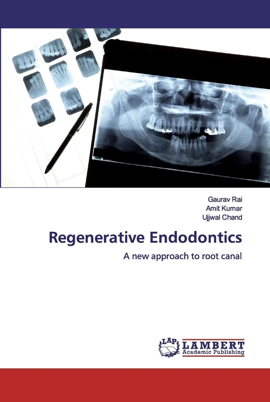 Regenerative Endodontics: A new approach to root canal