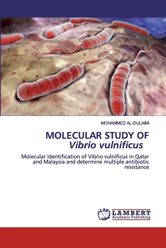 MOLECULAR STUDY OF Vibrio vulnificus: Molecular Identification of Vibrio vulnificus in Qatar and Malaysia and determine multiple antibiotic resistance