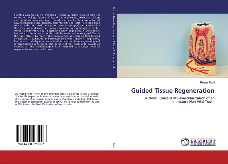 Guided Tissue Regeneration: A Novel Concept of Revascularization of an Immature Non Vital Tooth