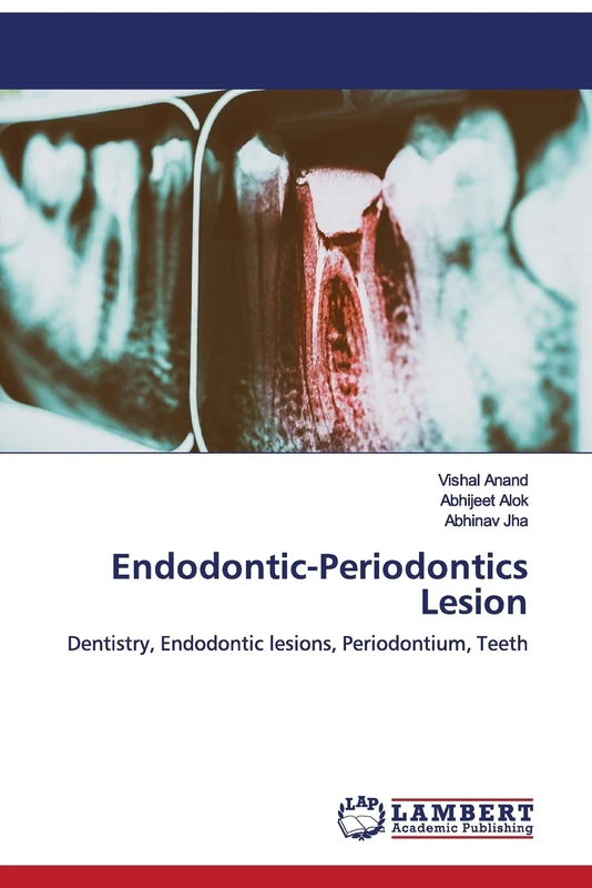 Endodontic-Periodontics Lesion: Dentistry, Endodontic lesions, Periodontium, Teeth