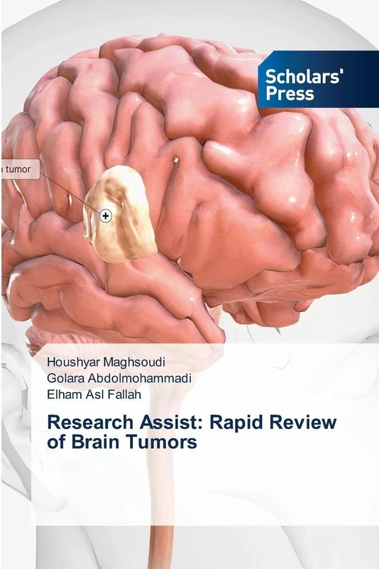 Research Assist: Rapid Review of Brain Tumors