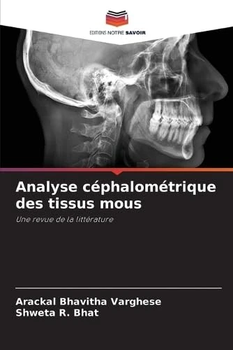 Analyse céphalométrique des tissus mous: Une revue de la littérature