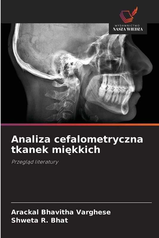 Analiza cefalometryczna tkanek miękkich: Przegl¿d literatury