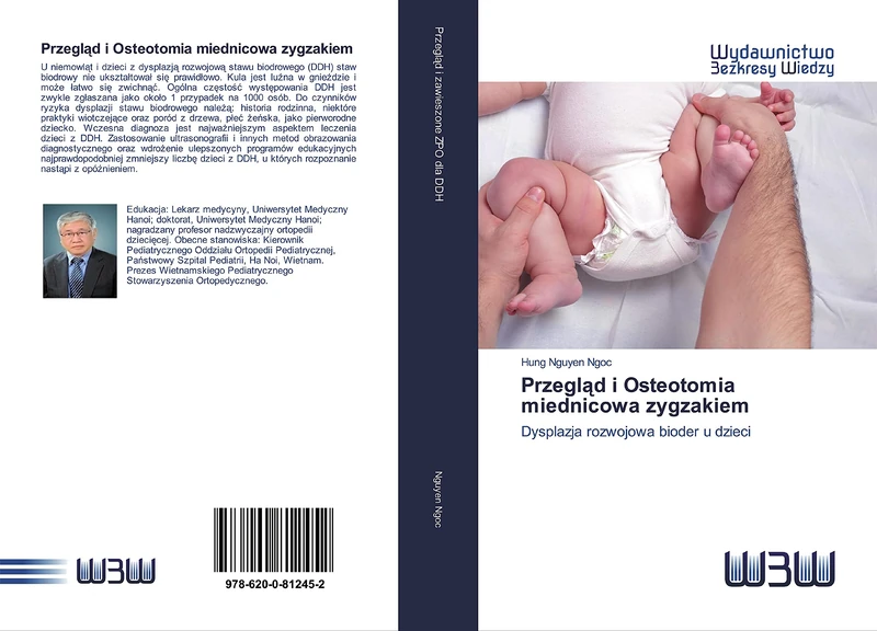 Przegląd i Osteotomia miednicowa zygzakiem: Dysplazja rozwojowa bioder u dzieci