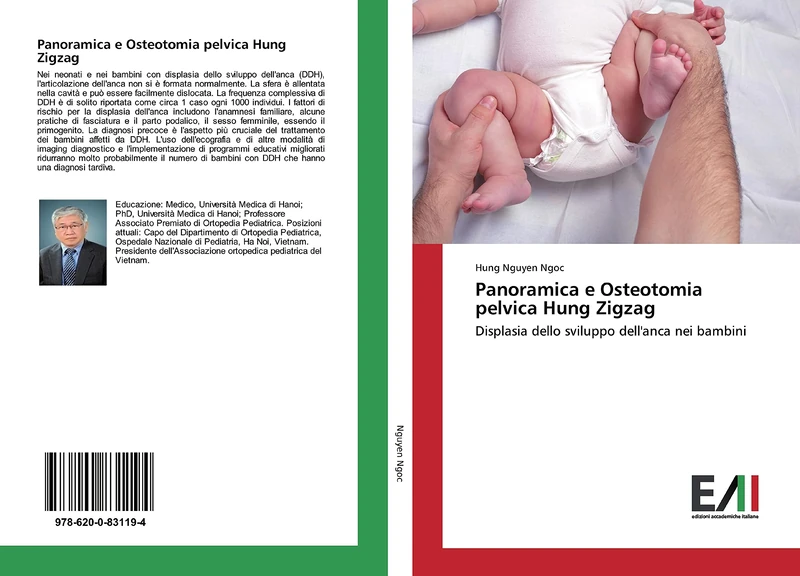 Panoramica e Osteotomia pelvica Hung Zigzag: Displasia dello sviluppo dell'anca nei bambini