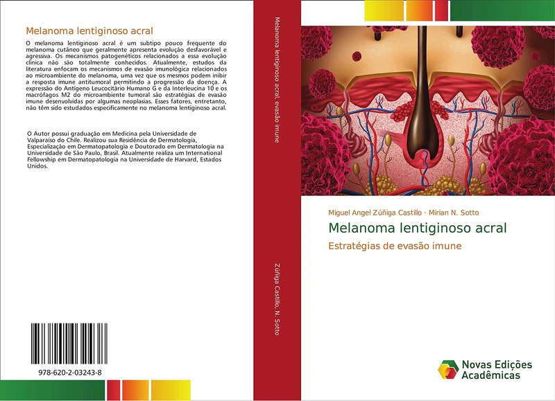 Melanoma lentiginoso acral: Estratégias de evasão imune: Estrate¿gias de evasa¿o imune - Image 1