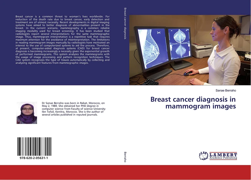 Breast cancer diagnosis in mammogram images