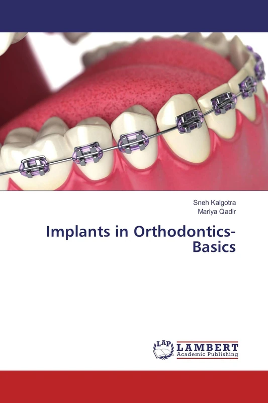 Implants in Orthodontics- Basics - Image 1