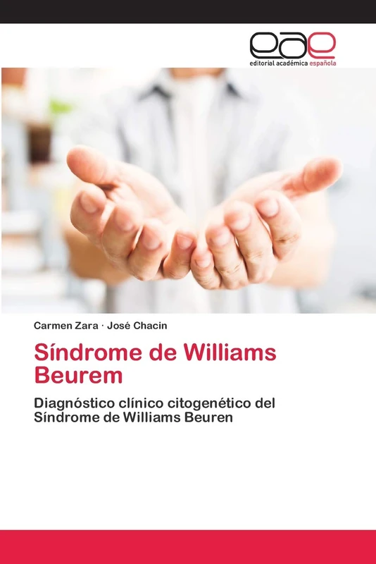 Síndrome de Williams Beurem: Diagnóstico clínico citogenético del Síndrome de Williams Beuren - Image 1