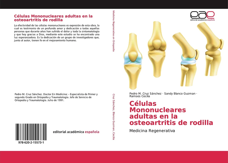 Células Mononucleares adultas en la osteoartritis de rodilla: Medicina Regenerativa - Image 1