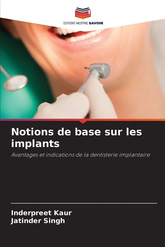Notions de base sur les implants: Avantages et indications de la dentisterie implantaire