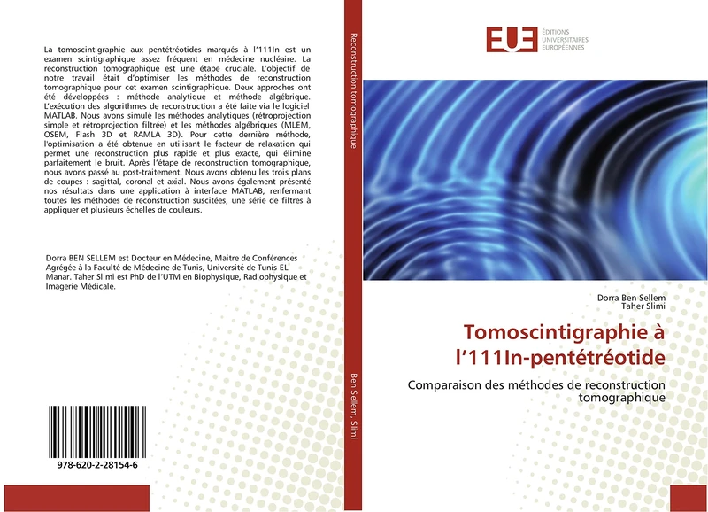 Tomoscintigraphie à l’111In-pentétréotide: Comparaison des méthodes de reconstruction tomographique