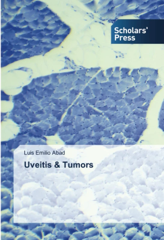 Uveitis & Tumors