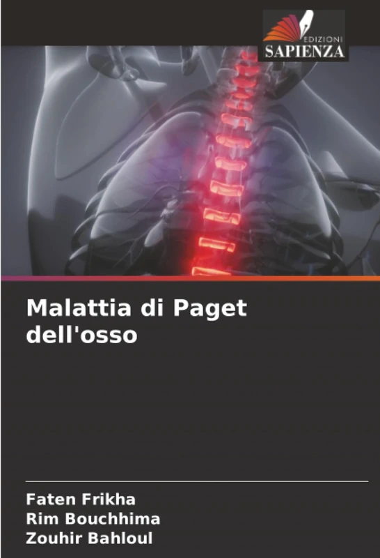 Malattia di Paget dell'osso