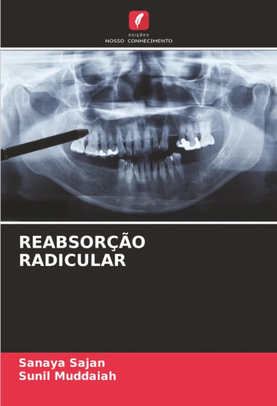 REABSORÇÃO RADICULAR