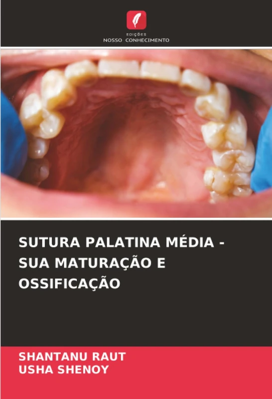 SUTURA PALATINA MÉDIA - SUA MATURAÇÃO E OSSIFICAÇÃO
