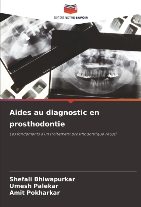 Aides au diagnostic en prosthodontie: Les fondements d'un traitement prosthodontique réussi