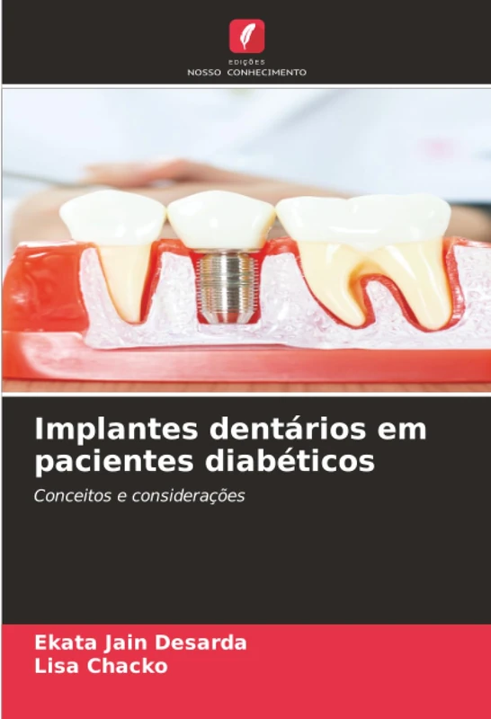 Implantes dentários em pacientes diabéticos: Conceitos e considerações