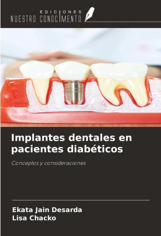 Implantes dentales en pacientes diabéticos: Conceptos y consideraciones