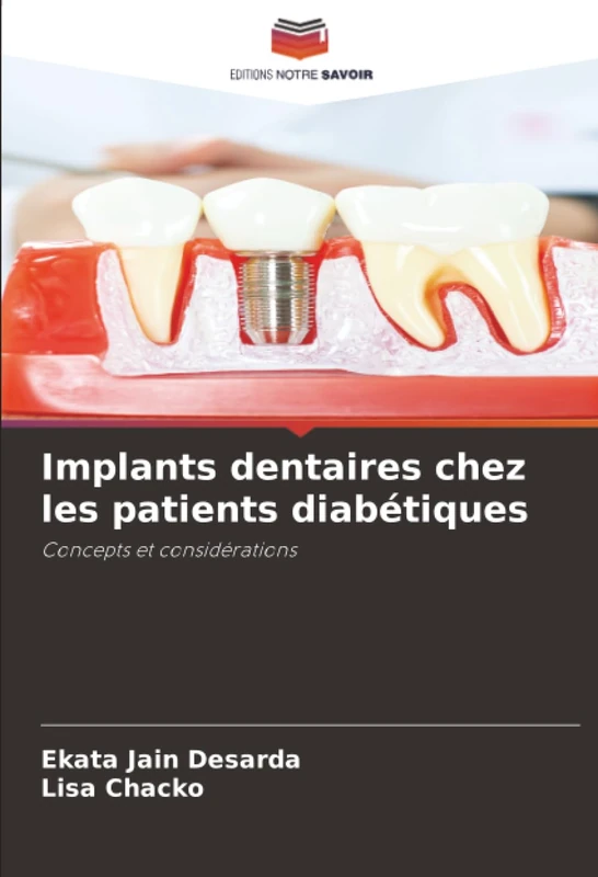 Implants dentaires chez les patients diabétiques: Concepts et considérations