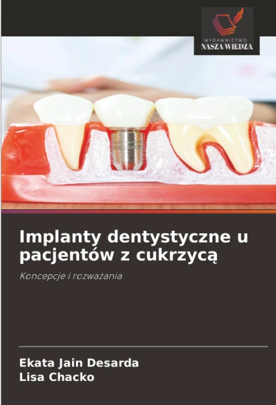 Implanty dentystyczne u pacjentów z cukrzycą: Koncepcje i rozważania