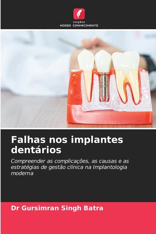 Falhas nos implantes dentários: Compreender as complicações, as causas e as estratégias de gestão clínica na Implantologia moderna