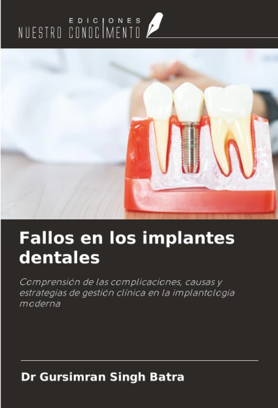 Fallos en los implantes dentales: Comprensión de las complicaciones, causas y estrategias de gestión clínica en la implantología moderna