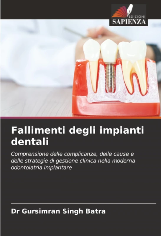 Fallimenti degli impianti dentali: Comprensione delle complicanze, delle cause e delle strategie di gestione clinica nella moderna odontoiatria implantare