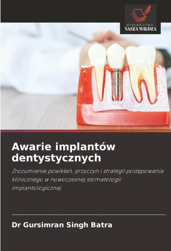 Awarie implantów dentystycznych: Zrozumienie powikłań, przyczyn i strategii postępowania klinicznego w nowoczesnej stomatologii implantologicznej: ... w nowoczesnej stomatologii implantologicznej