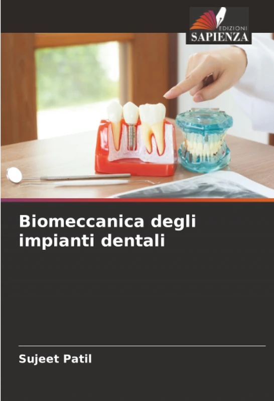 Biomeccanica degli impianti dentali