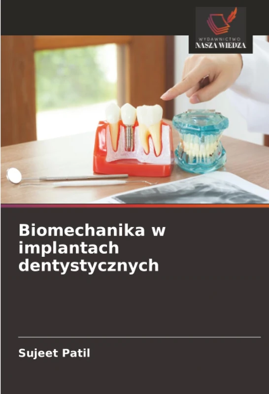 Biomechanika w implantach dentystycznych