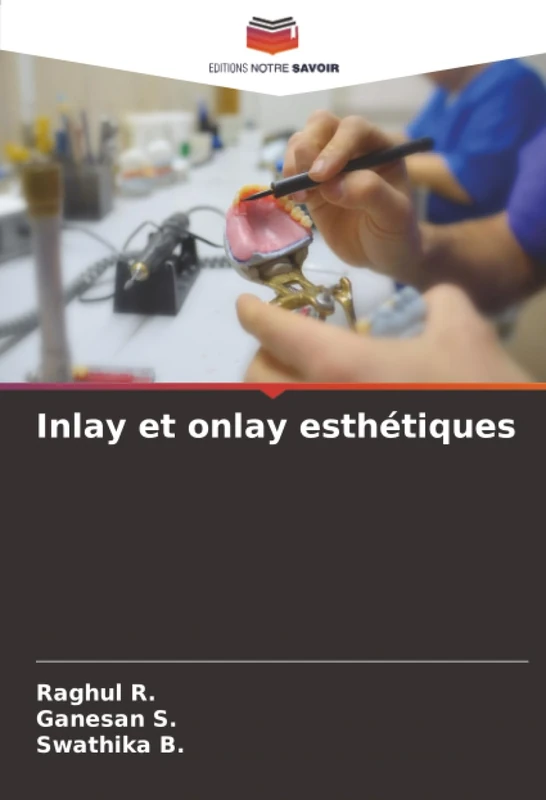 Inlay et onlay esthétiques