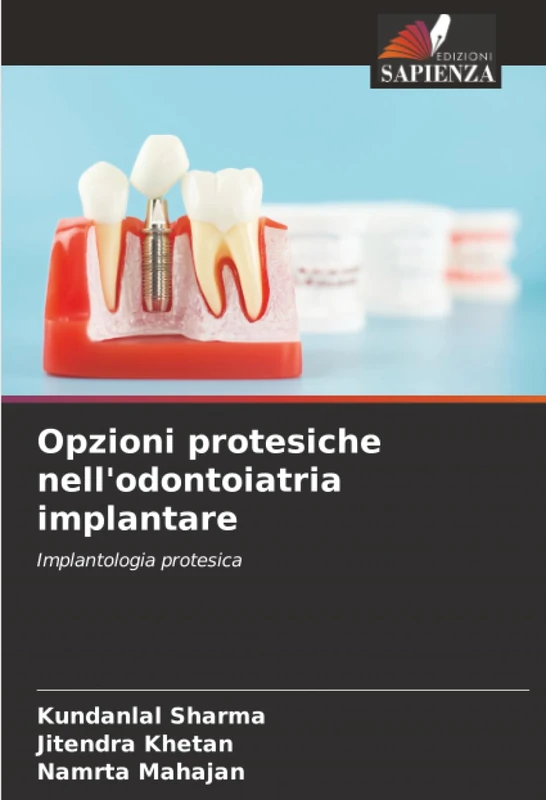 Opzioni protesiche nell'odontoiatria implantare: Implantologia protesica