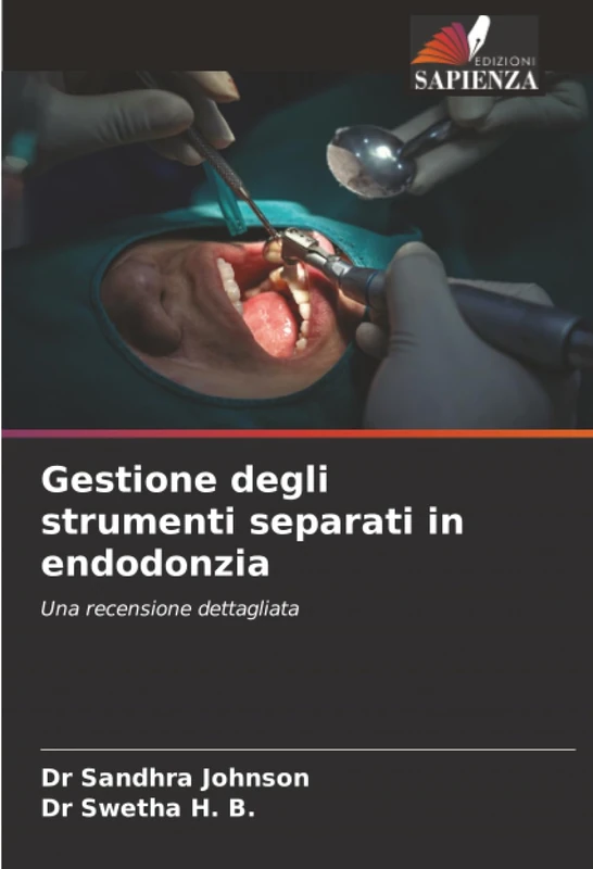 Gestione degli strumenti separati in endodonzia: Una recensione dettagliata